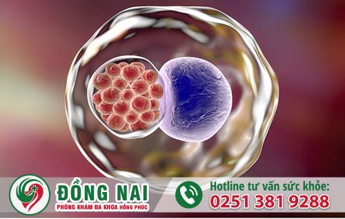 Địa chỉ chữa trị bệnh Chlamydia ở Biên Hòa Đồng Nai