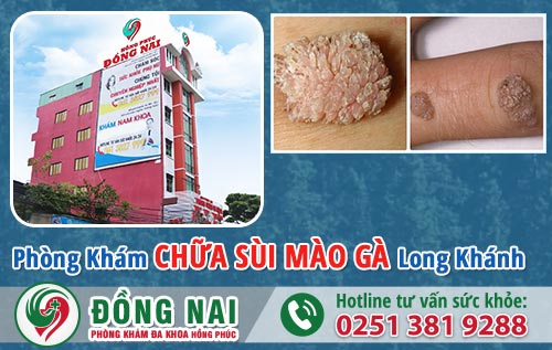 Phòng khám chữa bệnh sùi mào gà tại Long Khánh tốt