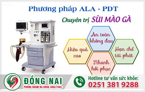 Phương pháp ALA - PDT chuyên điều trị bệnh sùi mào gà tại Long Khánh