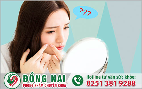 Qua tuổi dậy thì có hết mụn không?