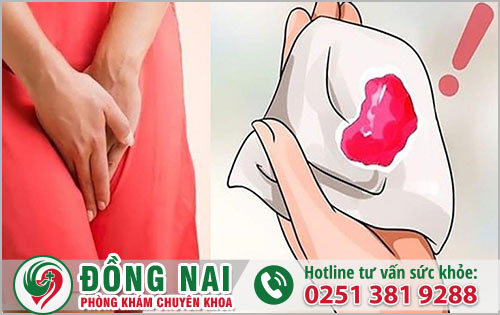 Tại sao triệu chứng chảy máu vùng kín ở phái đẹp không nên xem nhẹ　