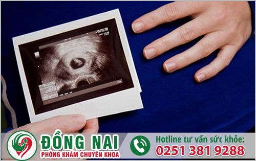 Thai 6 tuần nên thực hiện đình chỉ an toàn với lí do nào?