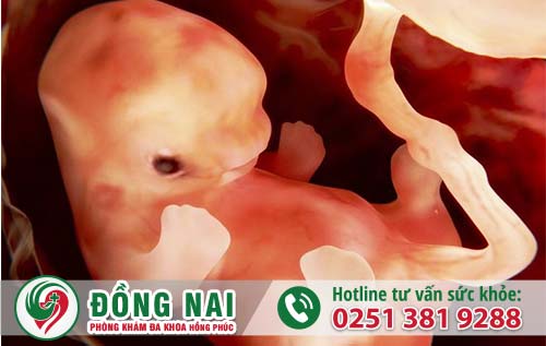 Thai chết lưu có tự tiêu hay không? Cần phải xử lý như thế nào?