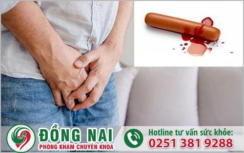 Thật nguy hiểm khi bao quy đầu chảy máu bởi nhiều nguyên nhân bệnh lý