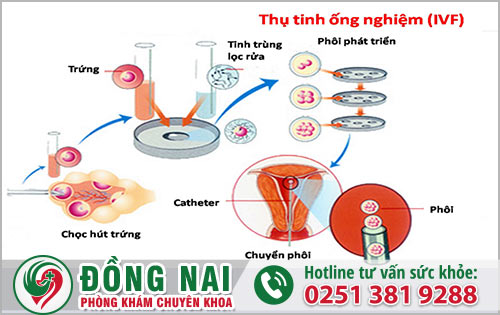 Quy trình thụ tinh trong ống nghiệm