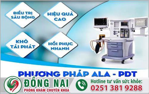 Hỗ trợ điều trị gai sinh dục hiệu quả bằng Phương pháp ALA – PDT