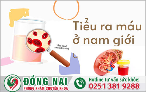 Tiểu ra máu ở nam giới cảnh báo bệnh gì?