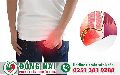 Rò hậu môn có ảnh hưởng đến sức khỏe không?