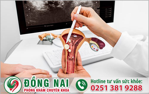 Tìm kiếm địa chỉ khám chữa trị bệnh phụ khoa tại Nhơn Trạch Đồng Nai?