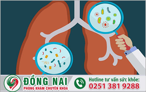 Tìm hiểu khái quát về chứng viêm phổi
