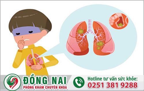 Trẻ bị viêm phổi bởi những yếu tố nào dẫn đến?