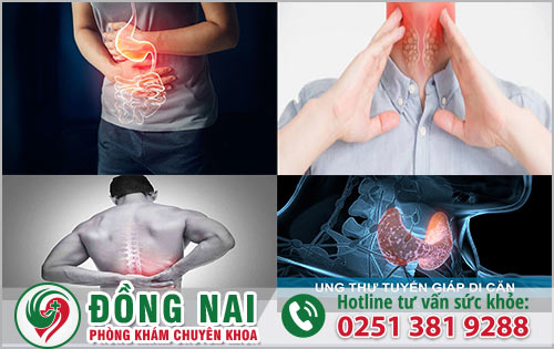 Ung thư tuyến giáp di căn đến nhiều bộ phận trong cơ thể