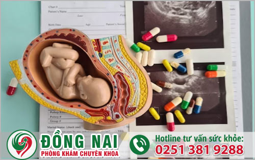 Phương pháp nội khoa chỉ áp dụng cho thai 7 tuần tuổi