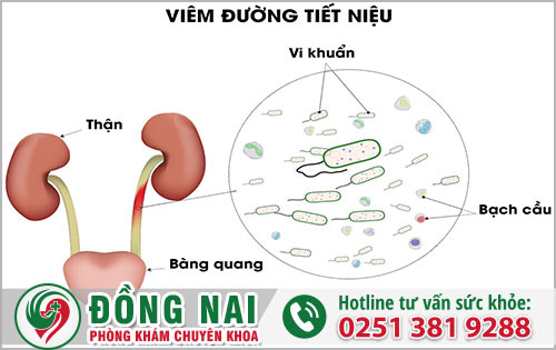 Viêm đường tiết niệu khi mang thai mà sản phụ cần quan tâm