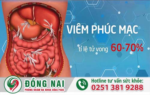 Biến chứng viêm phúc mạc là cực kỳ nguy hiểm