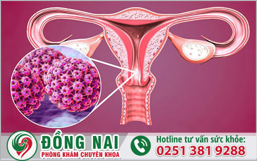 Virus HPV là nguyên nhân của những bệnh nào?