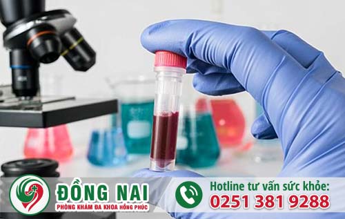 Xét nghiệm bệnh Chlamydia hết bao nhiêu tiền?