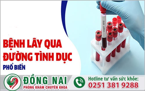 Những bệnh tình dục nào phổ biến khi xét nghiệm?